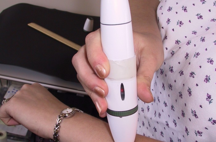 Laser Hair Removal Device